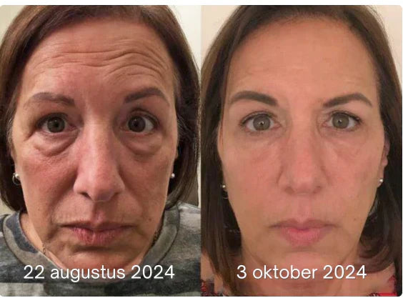 The Firming Peptide Lifting Serum