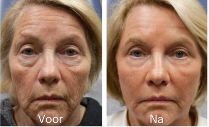 The Firming Peptide Lifting Serum